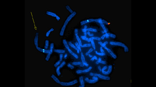 vysis-1p36-microdeletion-region-probe-hybridization-abnormal