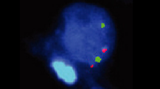 vysis-pten-cep-10-fish-probe-kit-hybridization-normal