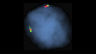 vysis-lsi-ccnd1-hybridization-normal