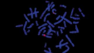 vysis-cep-12-spectrum-orange-hybridization-normal