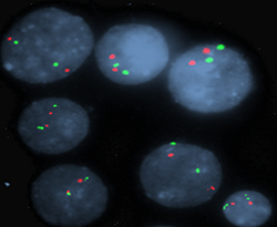 vysis-mdm2-cep-12-hybridization-image.