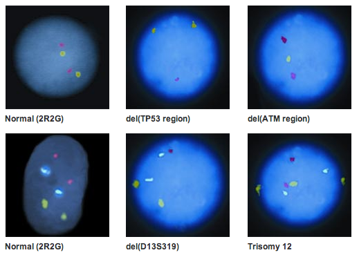 vysis-cll-fish-probe-kit-normal-hybridization