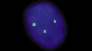 vysis-lsi-13-13q14-spectrumgreen-hybridization-normal