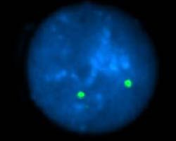 vysis-lsi-13q34-hybridization-normal