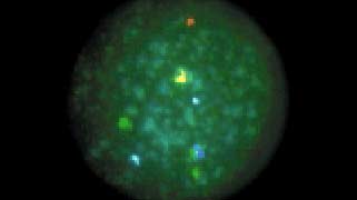 vysis-multivysion-pgt-multi-color-probe-hybridization-normal