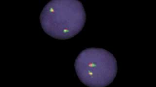 vysis-lsi-igh-dual-color-break-apart-rearrangement-probe-hybridization-normal