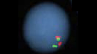 vysis-lsi-tra-d-dual-color-break-apart-rearrangement-hybridization-normal