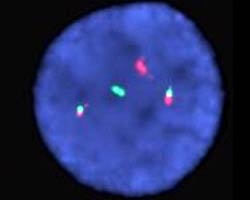 vysis-lsi-pml-rara-dual-color-dual-fusion-translocation-hybridization-abnormal.