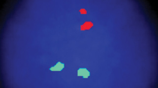 Vysis-LSI-IGH_MAF-Dual-Color2C-Dual-Fusion-Probe_NormalHybridization