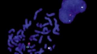 vysis-lsi-cbfb-dual-color-break-apart-rearrangement-hybridization-normal