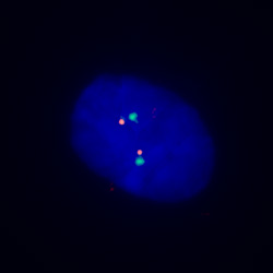 pathvysion-her-2-dna-probe-kit-II-hybridization-normal