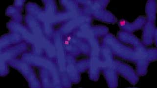 vysis-lsi-p53-17p13-1-hybridization-normal