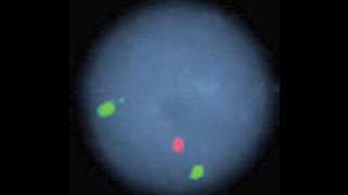 vysis-tp53-cep-17-fish-probe-kit-hybridization-abnormal