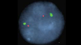 vysis-tp53-cep-17-fish-probe-kit-hybridization-norma