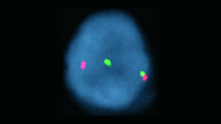 Vysis-LSI-BCL2-Break-Apart-FISH-Probe-kit_NormalHybridization