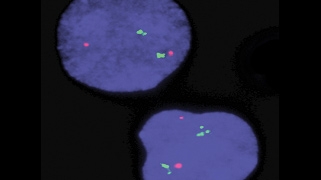 vysis-lsi-igh-malt1-dual-color-dual-fusion-hybridization-normal
