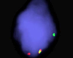 vysis-lsi-malt1-dual-color-break-apart-rearrangement-probe-hybridization-abnormal