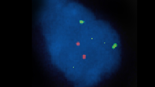 Vysis-LSI-1p36-_-LSI-1q25-and-LSI-19q13_19p13-Dual-Color-Probe_NormalHybridization1