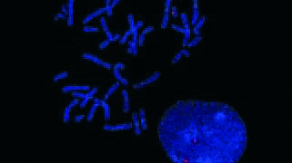 Vysis-D20S108-FISH-Probe-Kit_NormalHybridization.