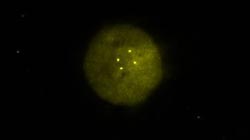 vysis-aurka-spectrumgold-fish-probe-kit-hybridization-abnormal