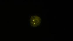 vysis-aurka-spectrumgold-fish-probe-kit-hybridization-normal