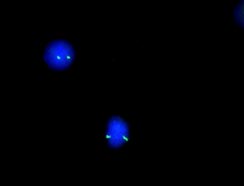 ysis-lsi-aml1-eto-dual-color-dual-fusion-translocation-hybridization-normal