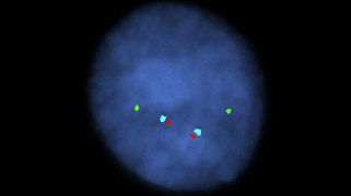 Vysis-BCR_ABL1_ASS1-Tri-Color-DF-FISH-Probe_NormalHybridization