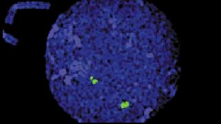 Vysis-LSI-22-(BCR)-SpectrumGreen-Probe_NormalHybridization