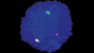 Vysis-LSI-BCR_ABL-Dual-Color-2C-Single-Fusion-Translocation-Probe_Hybridization