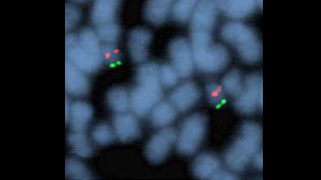 vysis-digeorge-region-probe-lsi-tuple1-hira-spectrumorange-telvysion-22q-spectrumgreen-hybridization-normal