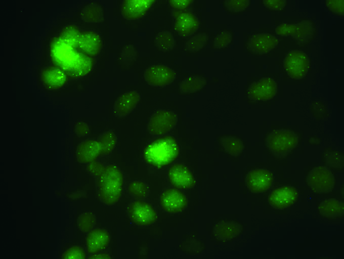 Vysis-PIK3CA-SpectrumGreen-Probe-Kit_Hybridization-2
