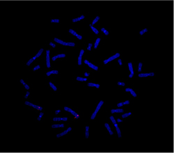 vysis-lsi-mecom-hybridization-normal