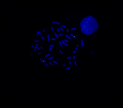vysis-lsi-rpn1-hybridization-normal