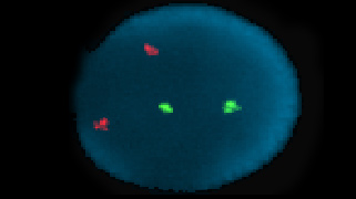 vysis-lsi-igh-fgfr3-dual-color-dual-fusion-hybridization-normal