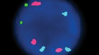 Vysis lsi ds