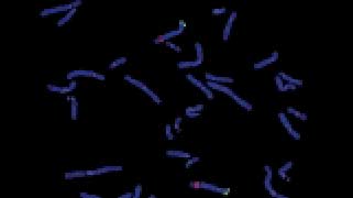 vysis-lsi-csf1r-spectrumorange-d5s23-d5s72-spectrumgreen-probes-normal-hybridization