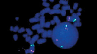 vysis-lsi-egr1-d5s23-d5s721-5p15.2-hybridization-normal