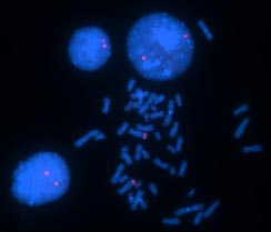vysis-lsi-pdgfrb-cen-hybridization-normal.