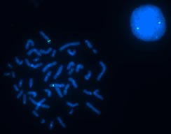 vysis-lsi-pdgfrb-tel-hybridization-normal