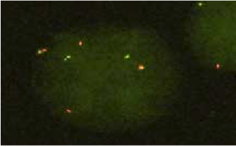 Vysis-6q22-ROS1-Break-Apart-FISH-Probe-Hybridization