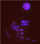 Vysis-6q22-ROS1-Break-Apart-FISH-Probe-Hybridization