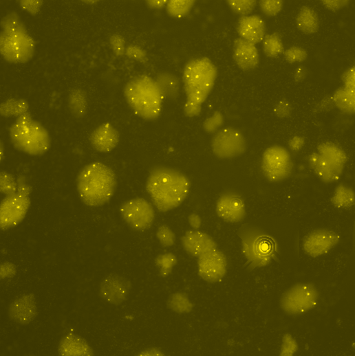 vysis-braf-spectrumgold-fish-probe-kit-hybridization-abnormal