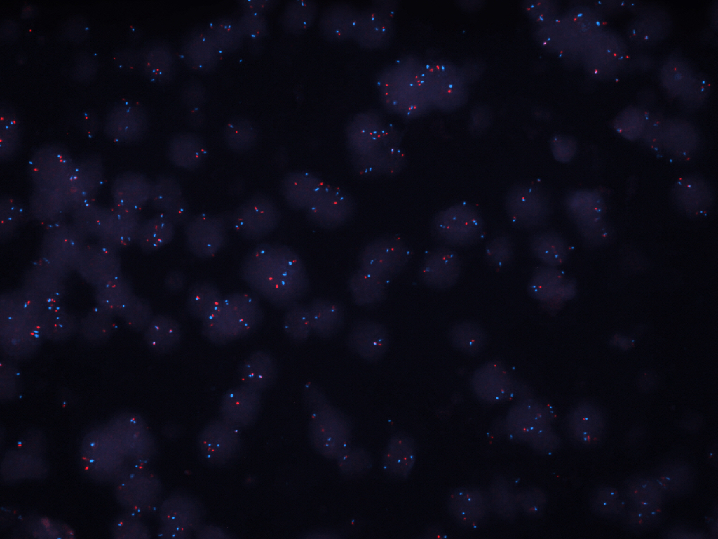 Vysis-8p12-FGFR1-SpecRed-CEP-8-SpecAqua-Hyb-Image-Normal