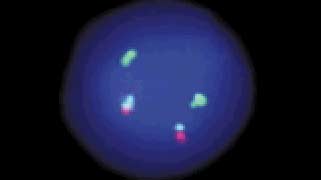 Vysis-LSI-IGH_MYC_CEP-8-Tri-Color-Dual-Fusion-Probe-Kit_Hybridization