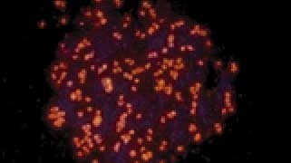 vysis-lsi-c-myc-8q24.12-q24.13-hybridization-normal