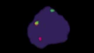 vysis-lsi-myc-dual-color-break-apart-rearrangement-hybridization-abnormal