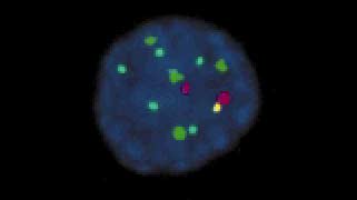 UroVysion_NormalHybridization