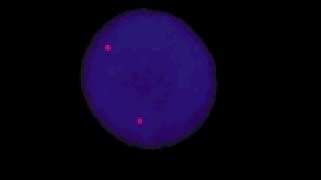 vysis-lsi-sts-hybridization-normal