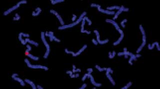 vysis-lsi-androgen-receptor-gene-xq12-hybridization-normal