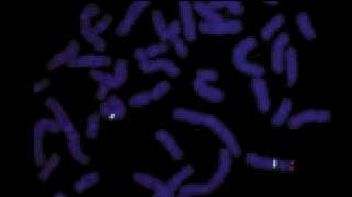 vysis-lsi-sts-hybridization-normal